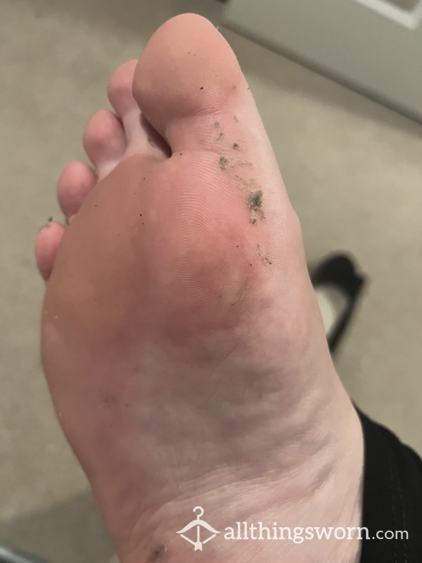 My Disgusting Sweaty Toe Jam! 🤢🧀🦶