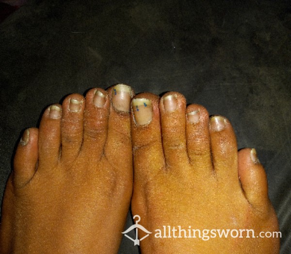 Toe Nails